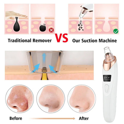 Electric Blackhead Remover Vacuum Suction USB Facial Pore Cleaner Spot Acne Pimple Black Head Extractor Face Clean Skin Care